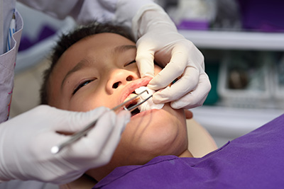 child getting his teeth cleaned at Bishop Arts Pediatric Dentistry
